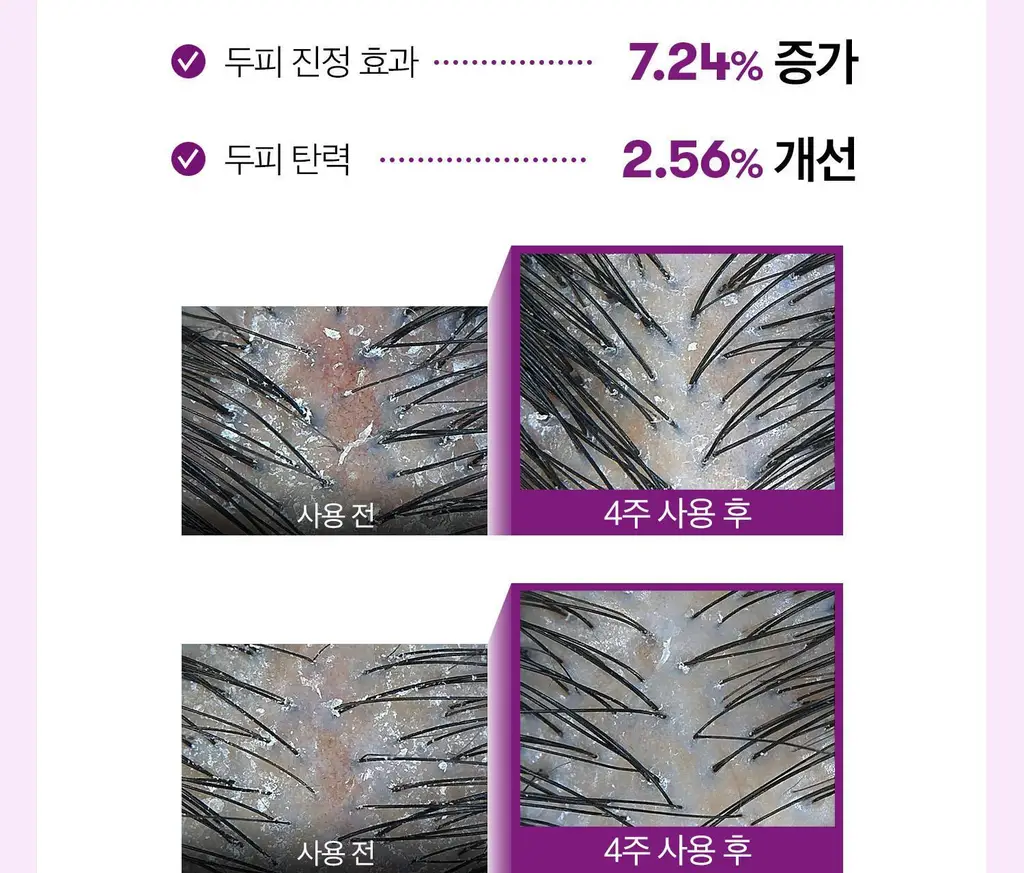 [더블기획][뿌리볼륨/탈모관리] VT 리들샷 헤어 부스팅 앰플 100디엘 단품/기획 2종 택 1 상세페이지 17